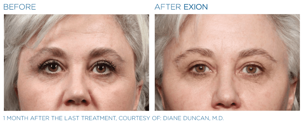 Exion PIC Ba card eyes female 014 FRF ENUS100 Exion