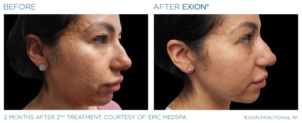 Exion PIC Ba card face female 071 FRF ENUS100 Exion