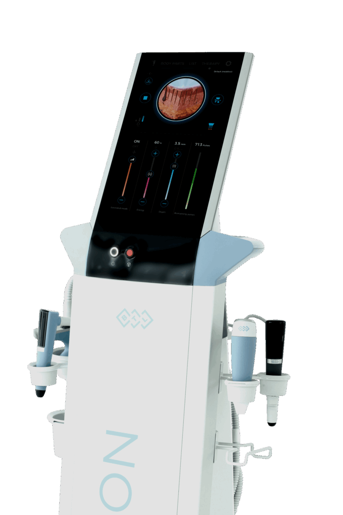 Exion PIC Device half fractional 4938 ENUS100 Exion