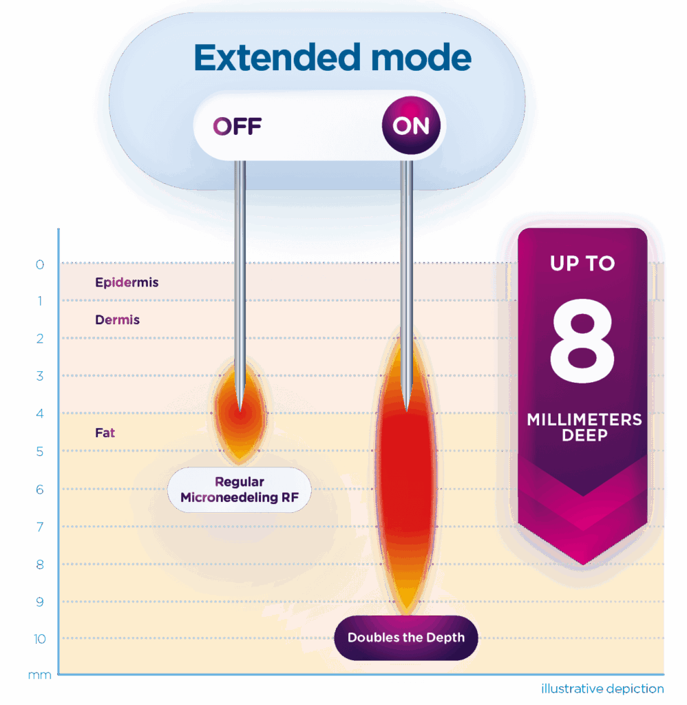 Exion PIC MOA Fractional RF ENUS100 Exion